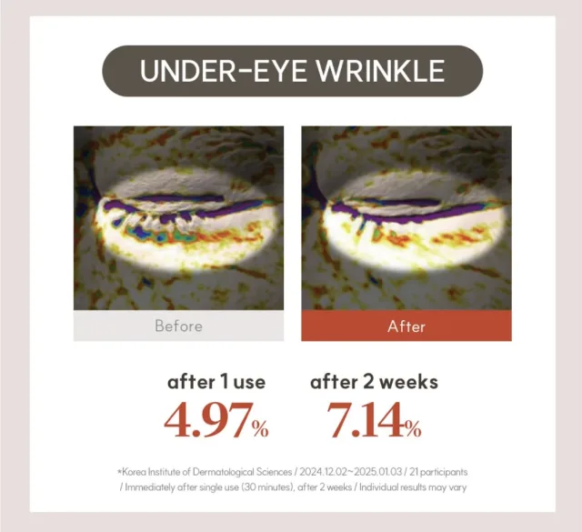 MARSHIQUE Wrinkle Repair Hydrogel Eye Patch – foto 8