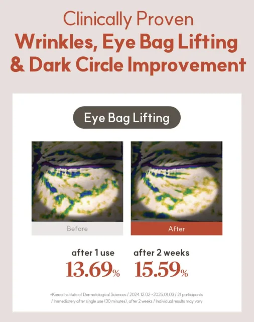 MARSHIQUE Wrinkle Repair Hydrogel Eye Patch – foto 6