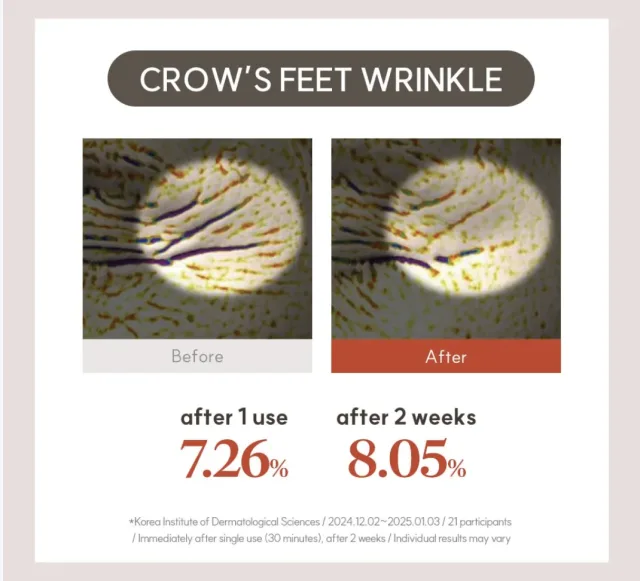 MARSHIQUE Wrinkle Repair Hydrogel Eye Patch – foto 7